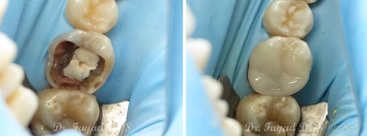 Dental before and after photo