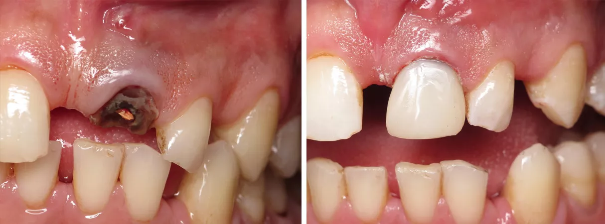 Dental before and after photo