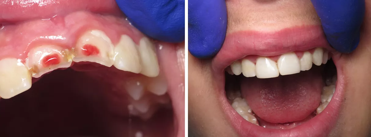 Dental before and after photo