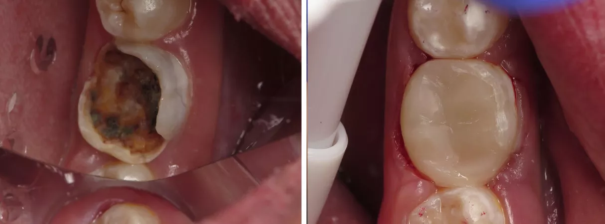 Dental before and after photo